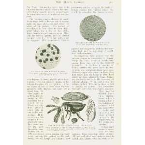    1912 Black Plague Bubonic Plague Disease Fleas 