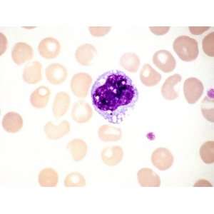  Monocyte Leukocyte or White Blood Cell Surrounded by Red Blood Cells 