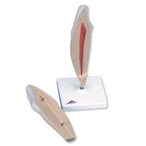 3B Scientific D10/2 2 Part Lower Canine Tooth Model:  