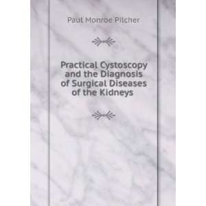  Practical Cystoscopy and the Diagnosis of Surgical 