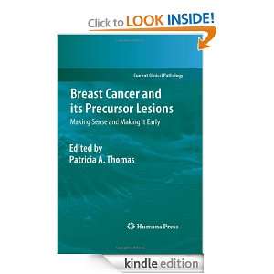 Breast Cancer and its Precursor Lesions Making Sense and Making It 