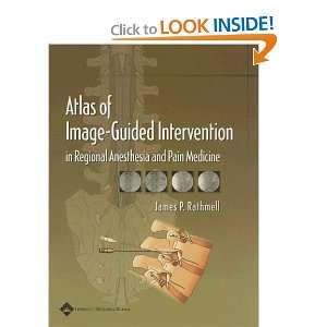  Atlas of Image Guided Intervention in Regional Anesthesia 